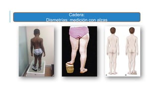 Taller Malformaciones y alteraciones ortopedicas DMOJ FINAL ...