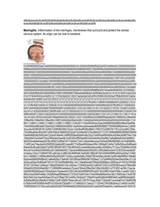 d6bdbdcec6c6ceb5b5bdb5bdbdbdbdbdc6c6bdd6cec6d6d6c6cec6bdcec6bdd6cec6cecebdded6c
ecec6bdd6d6c6cec6b5d6cebdd6cebdd6cec6cec6b5d6cec6d6

Meningitis: Inflammation of the meninges, membranes that surround and protect the central
nervous system. Its origin can be viral or bacterial.




010009000003a27a00000000e945000000001610000026060f002220574d464301000000000001
00f9e50000000004000000002000005848000058680000010000006c0000000000000000000000
65000000730000000000000000000000730c0000280e000020454d4600000100586800000c000
00001000000000000000000000000000000000400000003000040010000f000000000000000000
000000000000000e2040080a90300460000002c00000020000000454d462b014001001c000000
100000000210c0db010000006000000060000000460000000c0a0000000a0000454d462b22400
4000c000000000000001e4009000c00000000000000244001000c0000000000000030400200100
00000040000000000803f214007000c0000000000000008400005580900004c0900000210c0db0
10000000000000000000000000000000000000001000000ffd8ffe000104a464946000101000001
00010000ffdb004300090607080706090807080a0a090b0d160f0d0c0c0d1b14151016201d22222
01d1f1f2428342c242631271f1f2d3d2d3135373a3a3a232b3f443f384334393a37ffdb0043010a0a
0a0d0c0d1a0f0f1a37251f253737373737373737373737373737373737373737373737373737373
737373737373737373737373737373737373737373737ffc000110800740066030122000211010
31101ffc4001b00010100030101010000000000000000000001040506030207ffc4003710000202
02010204050203060700000000010200030411051221063141611314225171078115329123244
2a1b1c143525362637282ffc4001c01010002030101010000000000000000000005060103040702
08ffc4002f11000103020403070305000000000000000100020304110512213106415113617181a
1b1d122c1f03233425291ffda000c03010002110311003f00e3225895f5ebe924b108924b108a44b
108a44b108a44b108a44b1089124422b24b2422b112422b244422444422b244422444422b1110
891110891110891110891110891110891110b291110b0924b3c32dc54896595d965296a35e95b
74b3560ed803e875bef32d19880b5cf2f6513a4b5ec2ebeaebd69080866776095d68bd4cec7c800
3ccceb383f026767226473590f8359d15c5c720dbaff00bd88217f001f72266781781c23ce6672f4a
75538ea94e36cb901d90358c0396652032a91b3dfabf0379cd65d37731f21999a98983898bf3990b
f3ab8d665925952a472cbd236a4b1d8ff0008edb9d0c8b33c31bbf52a995d8dcd30bb3e96f76e7cfe
16b2dfd37e2da975a33f94aed3ae9b1b203853ff00ae803302efd3bcf4a89c7e6a8b6d03b2dd8651
5bf255cebfa4dae2678c3f0973d9b81917dd4d77e51c0bdddec2ea7b55d25f64804851e7bd6fd66c
71df91e279ac4e2b3f29f3532abb991aea8577d26ad062daecf5b13f4be813efe7326292ce3b86ae0
8ebe58c8caf22fde57e5f978f93819f7f1f9c895e551aea08dd4aca46c329d0ec7f13ce763fa9bc535b
9dc3e7e3db5d365b69c2b19d0b6d58175ecbdd882ada03b9240138fc9a6dc2e47230322caadb29
d1ebac15ec77d994f7561af23ec7c88335399f4e61b2b56198b367b4329fafdf9fb2492c4d4a71489
621148962114989c864d35d3625877a50cc3a0b0d6c766d7903e5fbcc8c8b7e063db69ff0216fe82
6d2be296bf0fdf8bd21afbe826c73e6d615f33f83e5f892587509aa7137b06fbf2554e29e206e15132
20dcce92e35d80e674f1d1767fa5f9d8b99e13c718edbbeb67f9a52006f8acc5893ec41047b76f49b
2f18716794e1326aa716bbf20840010a1d93ac1755623e9257a803f733f31e3f3f3f83cee3798e28b
594e653555938a58017109f48f63adebdc7bced784e53f8e59d18fe33b0651d7f74f91a29b17ee3a
5d5893f82662ae91f04a5dcb7beaaa547591d4c400df98f45f5cbf2183c9f872de0788c1caaf2722b1
8f5e1be2594fcbfbb120280badf99debd7737fc570d5f1b917e4365e666e45a16b17665c6c74a97f9
6b07fe51b27ee4924ee781e379fab7f07c485c76d2e571f5b0f7ee85260e5f88f3b81ad8f8930e829
d3fd8e460dc08bdb47482b73d61890076ea1dfcc01397570cac3bfe772ebd01cce5a6f1e73b88396
b78db334635985c6df9157d5d3d792e851177e842b311eec2711834d7463562bac212a0b7dc9d7
7d9f59ef4d1573dccd5caf2d52d97f2096de6b208550a502281ea02eff33eb93c1ab8dcea5f194578
 