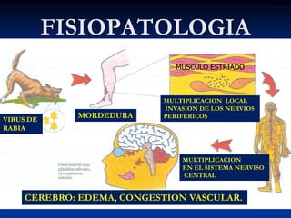 FISIOPATOLOGIA
MUSCULO ESTRIADO
CEREBRO: EDEMA, CONGESTION VASCULAR.
MULTIPLICACION LOCAL
INVASION DE LOS NERVIOS
PERIFERICOS
MULTIPLICACION
EN EL SISTEMA NERVISO
CENTRAL
MORDEDURA
VIRUS DE
RABIA
 