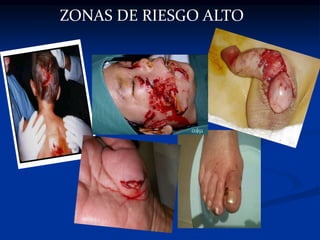 ZONAS DE RIESGO ALTO
 