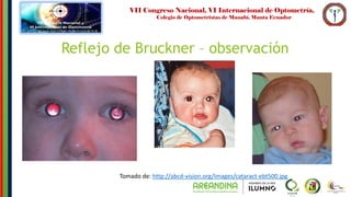 Taller reflejo de bruckner PPT