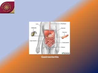 Gastroenterítis
 