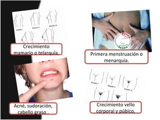 Primera menstruación o
menarquía.
Crecimiento
mamario o telarquía.
Acné, sudoración,
cabello graso .
Crecimiento vello
corporal y púbico.