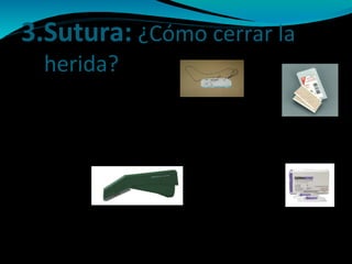 3.Sutura: ¿Cómo cerrar la
herida?
*Puntos de sutura
*Esparadrapos estériles o quirúrgicos
(puntos de aproximación) Steri-strips®
*Grapas
*Pegamentos sintéticos o adhesivos
tisulares Histoacryl® Dermabond®
 