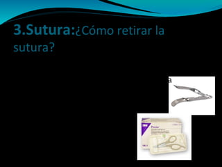 3.Sutura:¿Cómo retirar la
sutura?* Puntos de sutura:
- Utilizar pinza de disección
- Tirar de uno de los extremos de la
sutura
- Cortar el hilo por la zona mas
próxima a la piel
* Grapas:
- Utilizar un quita grapas
 