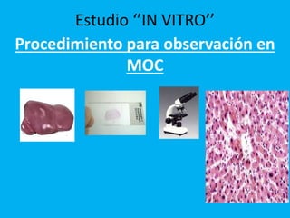 Procedimiento para observación en
MOC
Estudio ‘’IN VITRO’’
 