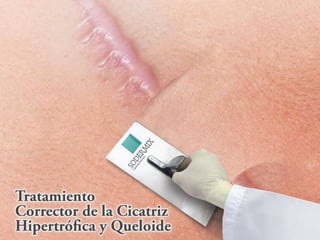 Curso Úlceras por Presión