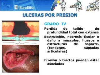 GRADO IV
Perdida de tejido de
profundidad total con extensa
destrucción, necrosis tisular o
daño a músculos, huesos o
estructuras de soporte.
(tendones, cápsulas
articulares)
Erosión o tractos pueden estar
asociados
 
