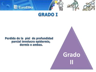 Grado
II
 