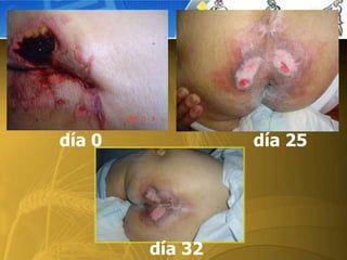 día 0 día 25
día 32
 