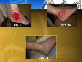 DIA 1
DIA 1 DIA 20
DIA 64
 