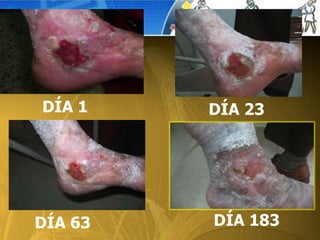 DÍA 1 DÍA 23
DÍA 63 DÍA 183
 