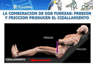 CIZALLAMIENTO
FRICCION
PRESION
 