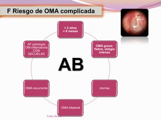 F Riesgo de OMA complicada
< 2 años
< 6 meses
OMA grave:
fiebre, otalgia
intensa
otorrea
OMA bilateral
OMA recurrente
AF patología
OM inflamatoria
CON
SECUELAS
AB
Esther Bernal
 
