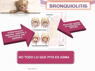 NO TODO LO QUE PITA ES ASMA
Esther Bernal
 