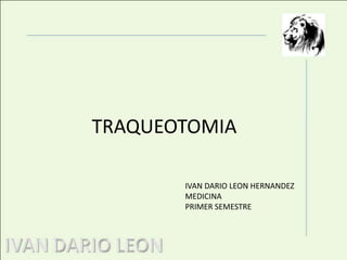 TRAQUEOTOMIAIVAN DARIO LEON HERNANDEZMEDICINAPRIMER SEMESTRE