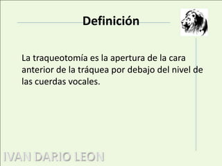 DefiniciónLa traqueotomía es la apertura de la cara anterior de la tráquea por debajo del nivel de las cuerdas vocales.