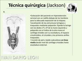 Retenciones respiratorias con aspiraciones frecuentes y neumonías de repetición.