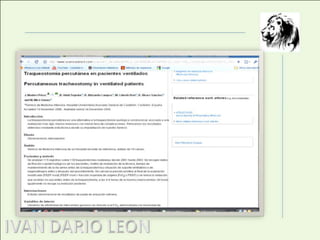 Técnica quirúrgica (Jackson)B.Colocación del paciente en hiperextensión cervical con un rodillo debajo de los hombros para la adecuada exposición de la tráquea. 