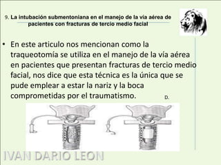 7. La traqueotomía no mejora el espacio muerto respecto a la intubación translaríngeaEn este articulo se puntualizan unas opiniones de doctores que discuten sobre las conclusiones de artículos pasados sobre la traqueotomía ellos concluyeron que la realización de la traqueotomía después de la intubación translaringea no disminuye el espacio muerto.