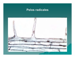 Pelos radicales 
 