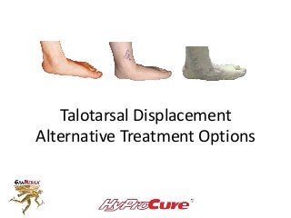 Talotarsal Displacement
Alternative Treatment Options
 