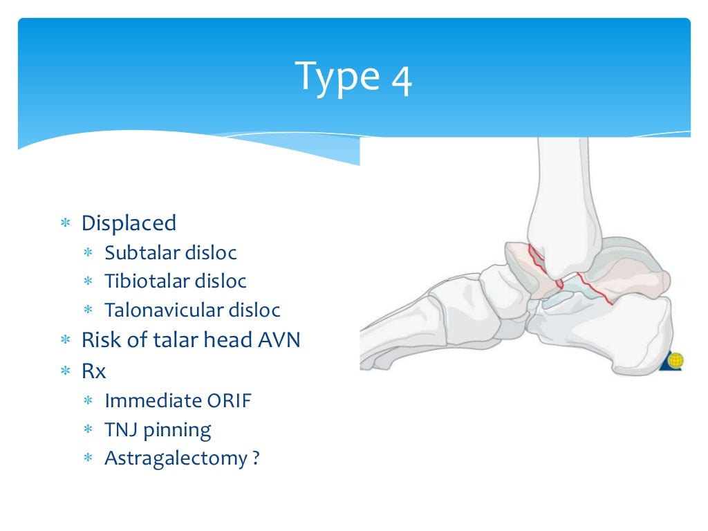 Talus anatomy, blood supply & fractures
