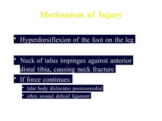 Talus+Fractures and subtalar dislocations.pptx