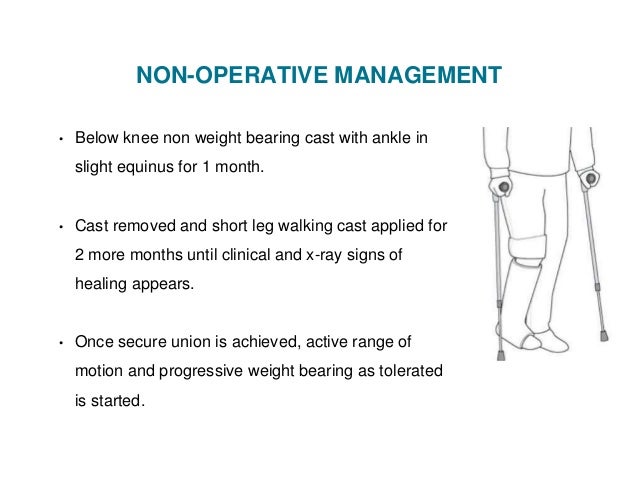 talus fracture treatment