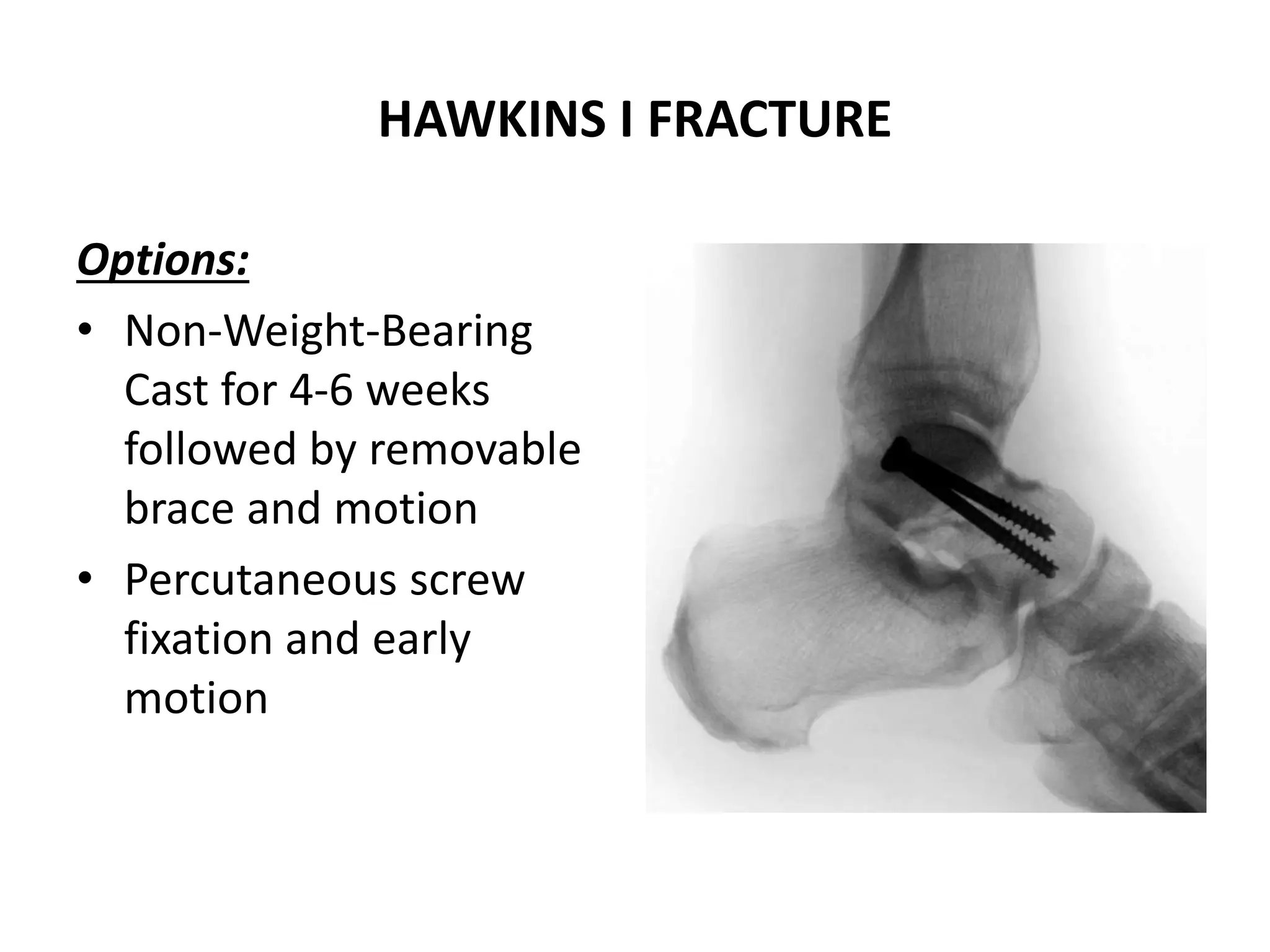 HAWKINS I FRACTURE
Options:
• Non-Weight-Bearing
Cast for 4-6 weeks
followed by removable
brace and motion
• Percutaneous screw
fixation and early
motion
 