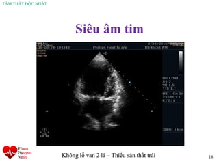 TÂM THẤT ĐỘC NHẤT
Siêu âm tim
18Không lỗ van 2 lá – Thiểu sản thất trái
 