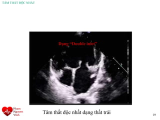 TÂM THẤT ĐỘC NHẤT
19
Dạng “Double inlet”
Tâm thất độc nhất dạng thất trái
 