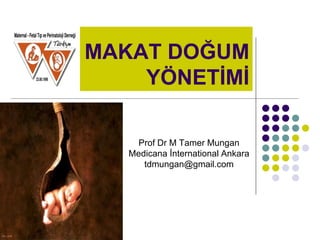 MAKAT DOĞUM
YÖNETİMİ
Prof Dr M Tamer Mungan
Medicana İnternational Ankara
tdmungan@gmail.com
 