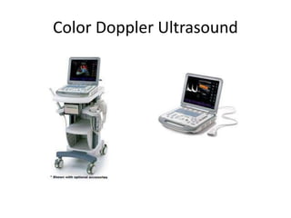 Color Doppler Ultrasound
 