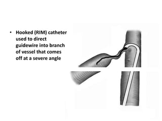 • Hooked (RIM) catheter
used to direct
guidewire into branch
of vessel that comes
off at a severe angle
 