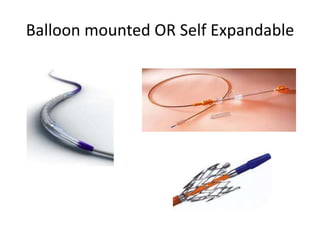Balloon mounted OR Self Expandable
 