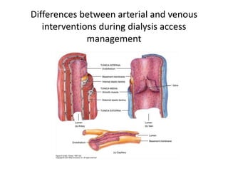 Differences between arterial and venous
interventions during dialysis access
management
 