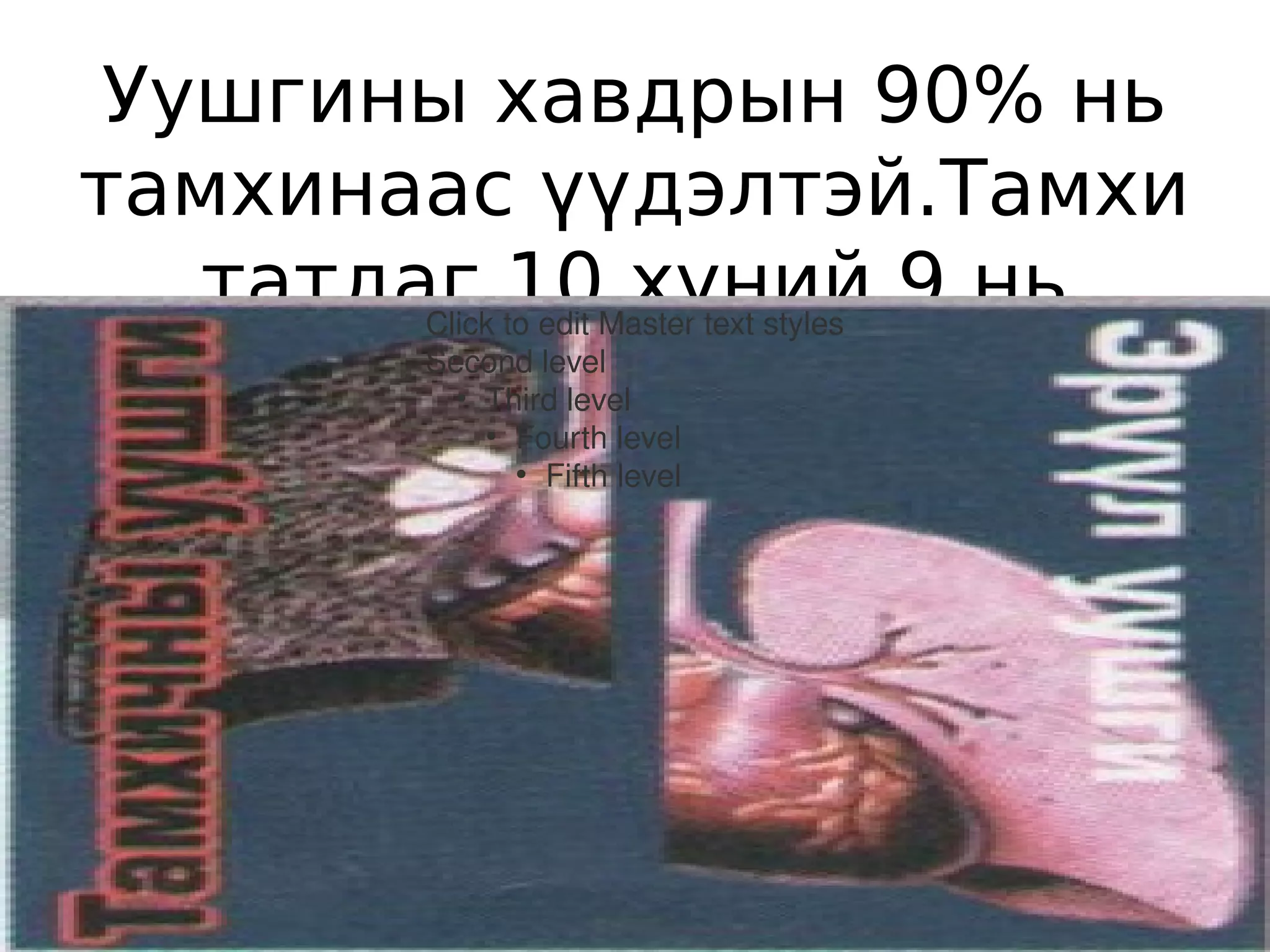 Уушгины хавдрын 90% нь
тамхинаас үүдэлтэй.Тамхи
   татдаг 10 хүний 9 нь
        Click to edit Master text styles

  уушгины хавдраар нас
        Second level
            Third level
             ●


               Fourth level
            бардаг.
                 ●


                 Fifth level
                     ●
 