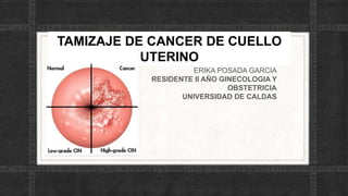 TAMIZAJE DE CANCER DE CUELLO
UTERINO
ERIKA POSADA GARCIA
RESIDENTE II AÑO GINECOLOGIA Y
OBSTETRICIA
UNIVERSIDAD DE CALDAS
 