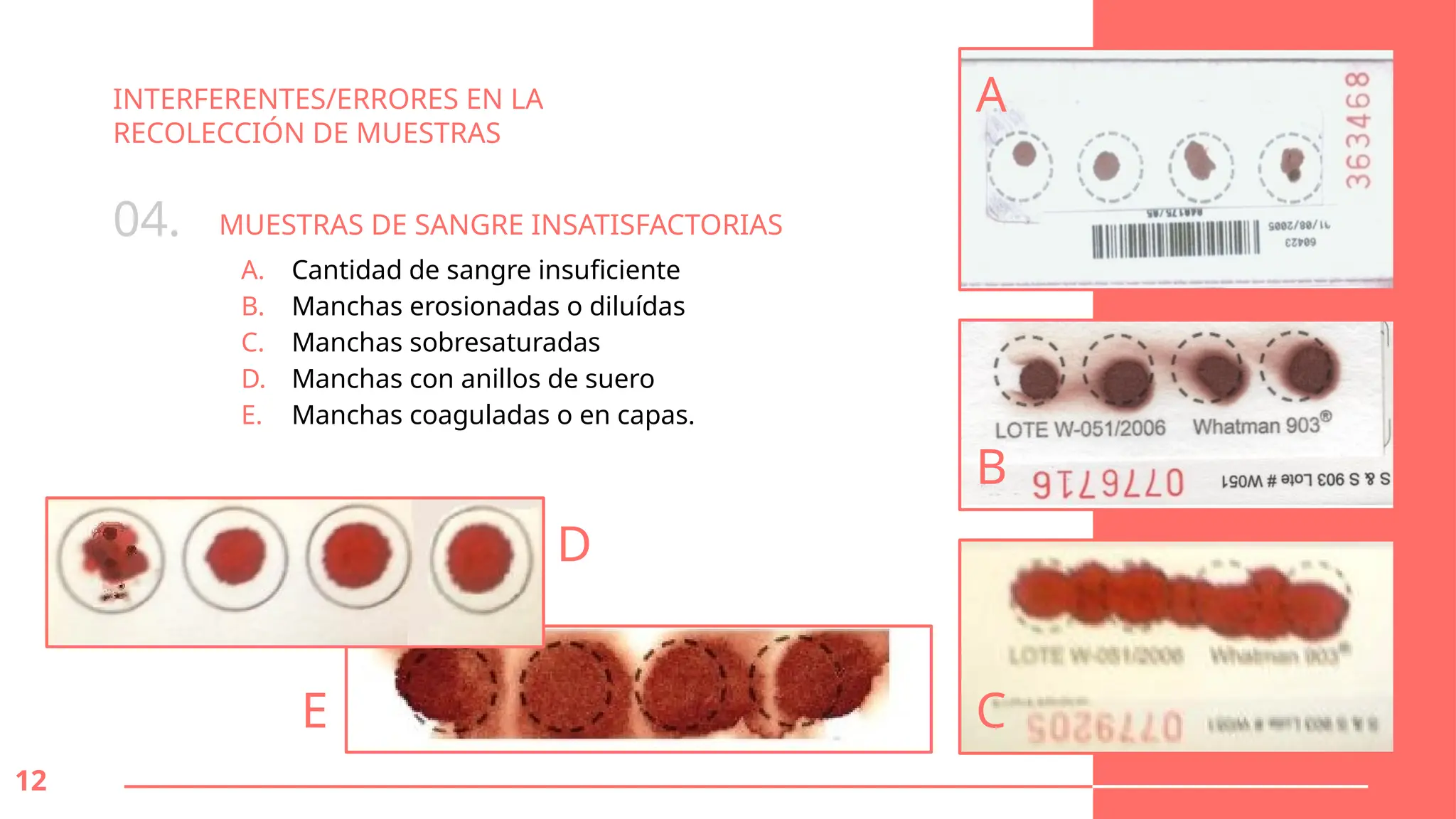 Tamizaje Metabolico Neonatal | PPTX