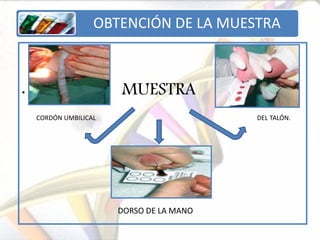 OBTENCIÓN DE LA MUESTRA



•                      MUESTRA
    CORDÓN UMBILICAL                      DEL TALÓN.




                       DORSO DE LA MANO
 