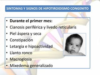SINTOMAS Y SIGNOS DE HIPOTIROIDISMO CONGENITO


•   Durante el primer mes:
•   Cianosis periférica y livedo reticularis
•   Piel áspera y seca
•   Constipación
•   Letargia e hipoactividad
•   Llanto ronco
•   Macroglosia
•   Mixedema generalizado
 