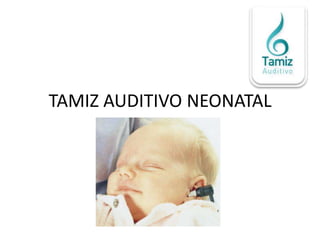 TAMIZ AUDITIVO NEONATAL
 