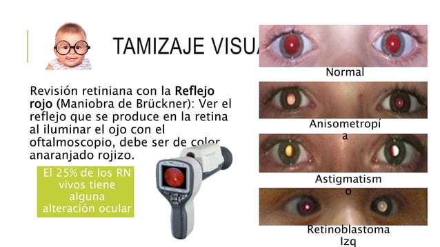 Tamiz neonatal
