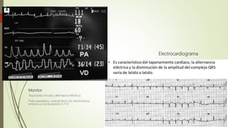 Monitor
Taquicardia sinusal y alternancia electrica.
Pulso paradójico característico con desincronica
entre la curva de presión A Y D
Electrocardiograma
 