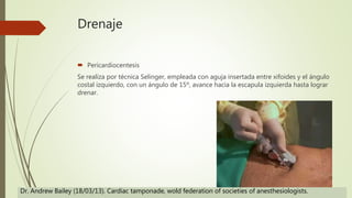 Drenaje
 Pericardiocentesis
Se realiza por técnica Selinger, empleada con aguja insertada entre xifoides y el ángulo
costal izquierdo, con un ángulo de 15º, avance hacia la escapula izquierda hasta lograr
drenar.
Dr. Andrew Bailey (18/03/13). Cardiac tamponade, wold federation of societies of anesthesiologists.
 