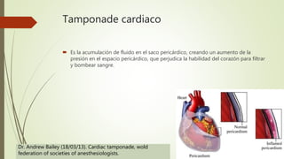 Tamponade cardiaco
 Es la acumulación de fluido en el saco pericárdico, creando un aumento de la
presión en el espacio pericárdico, que perjudica la habilidad del corazón para filtrar
y bombear sangre.
Dr. Andrew Bailey (18/03/13). Cardiac tamponade, wold
federation of societies of anesthesiologists.
 