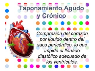 Taponamiento Agudo
     y Crónico

    Compresión del corazón
     por líquido dentro del
    saco pericárdico, lo que
       impide el llenado
    diastólico adecuado de
        los ventrículos.
 