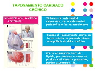 Tamponade cardiaco (AGUDO Y CRÓNICO)