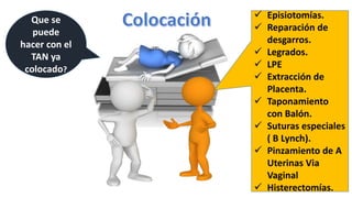 Que se
puede
hacer con el
TAN ya
colocado?
 Episiotomías.
 Reparación de
desgarros.
 Legrados.
 LPE
 Extracción de
Placenta.
 Taponamiento
con Balón.
 Suturas especiales
( B Lynch).
 Pinzamiento de A
Uterinas Via
Vaginal
 Histerectomías.
 